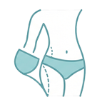 Skin removal